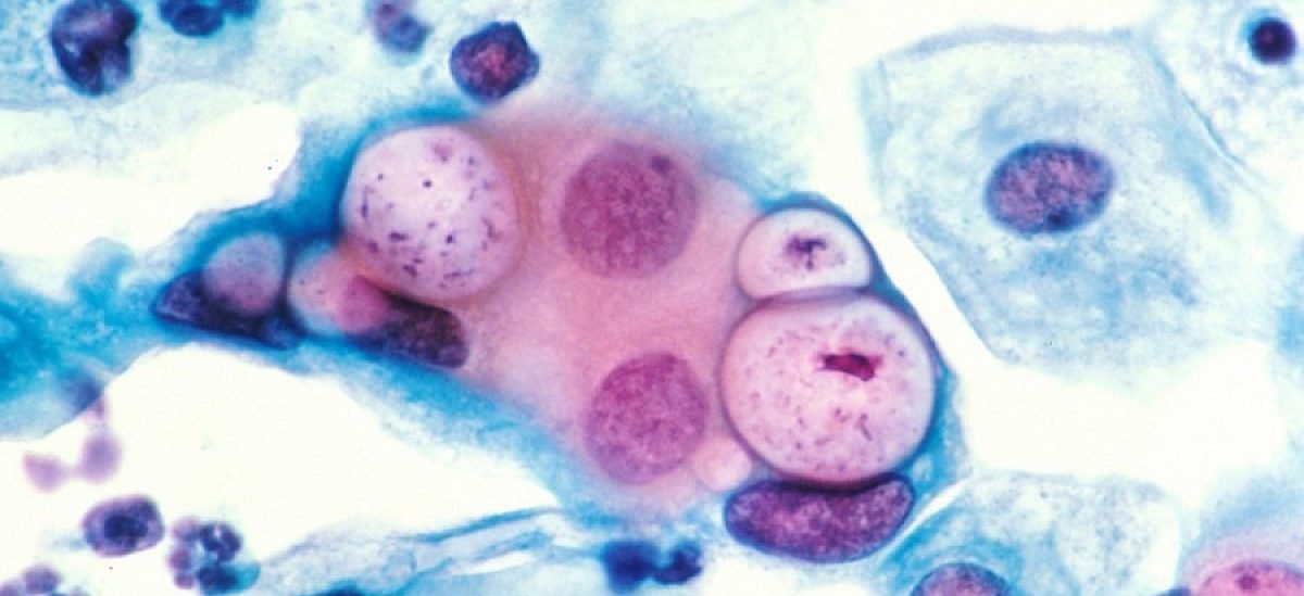 smartonosen-hantavirus-otne-tri-zhivota-na-kruizen-korab