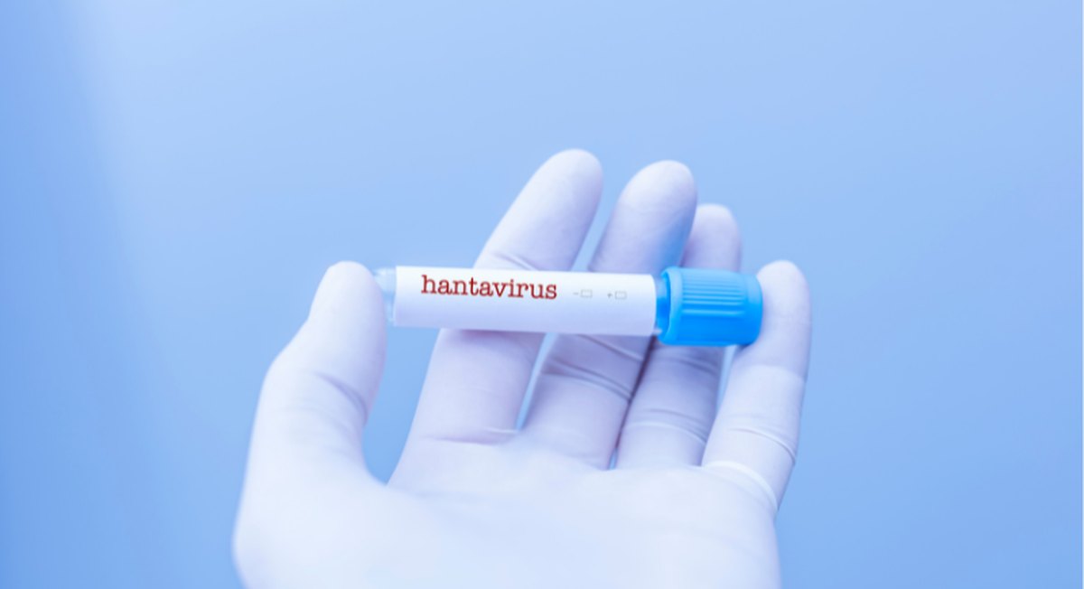 potvarden-e-sluchay-na-hantavirus-v-rumaniya-grad-arad
