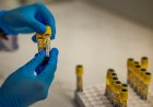 Световният отговор на ХИВ е под заплаха заради съкращения на финансирането